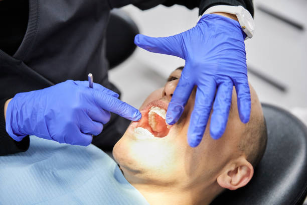 Best Emergency Tooth Extraction in Marlboro Village, MD