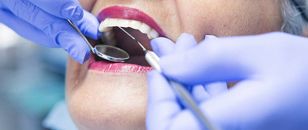 Best Emergency Wisdom Teeth Removal in Marlboro Village, MD